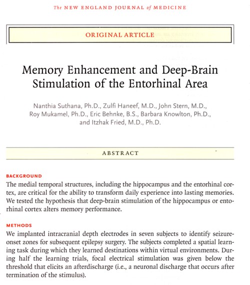 脳の電気刺激と記憶の回復.jpg